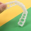 取り外し可能な歯科用ベニア - Snap On Smile 