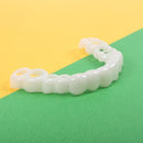 取り外し可能な歯科用ベニア - Snap On Smile 